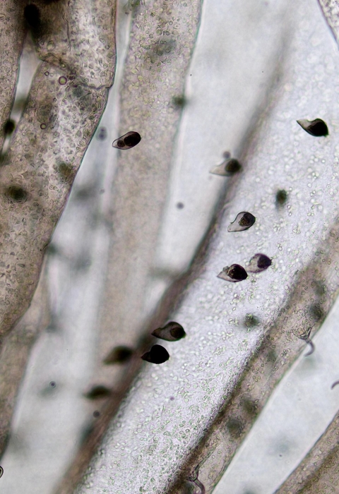 Silty pond mussel larvae under magnification
